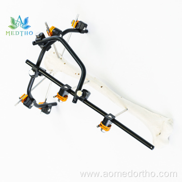 humerus fracture treatment